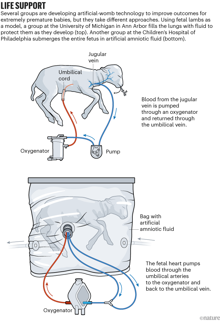 Artificial Womb Could Offer New Hope for Premature Babies